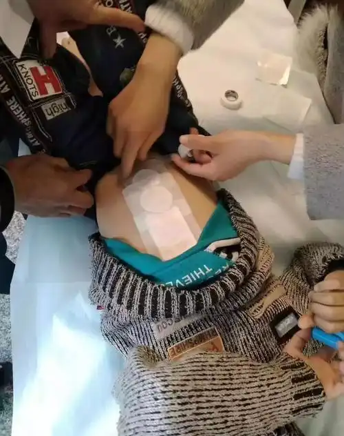 方城孩子感冒发烧来这家店不吃药不打针居然全好了这是