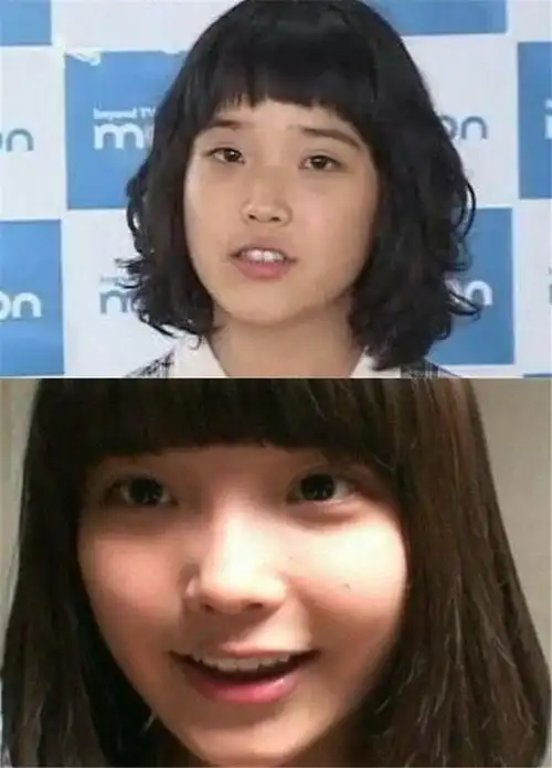 五官那么平淡的iu,也是整出来的?==之前一直不觉_圈子-新氧美容整形