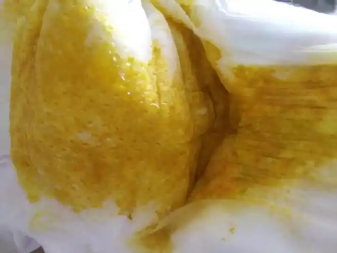 是拉肚子了吗?_百度宝宝知道