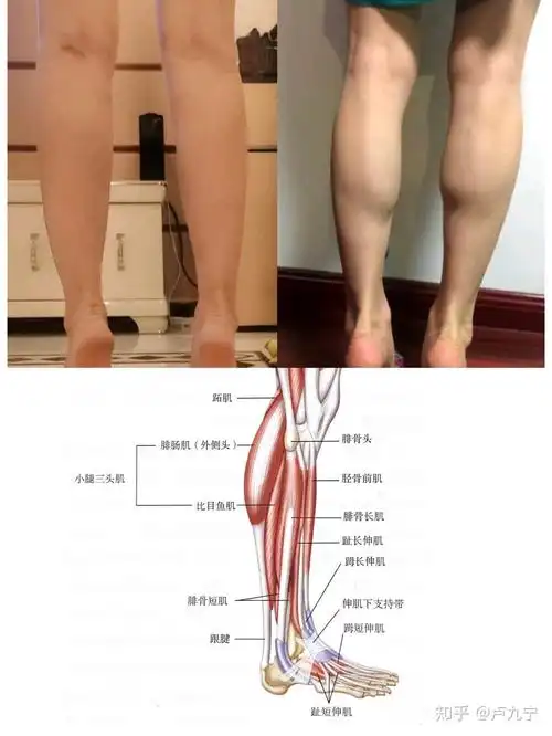 发达,腿部线条视觉上会粗犷,皮下脂肪较薄的人,小腿肌肉线条更突兀