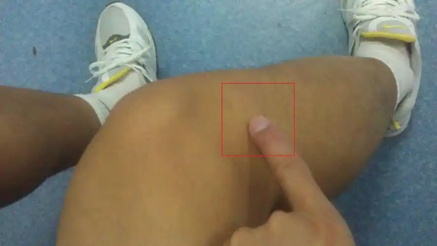 慢跑后,膝关节疼