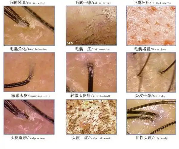 头皮毛囊检测仪头发脸部皮肤分析测试仪器理发店高清一体机带屏幕