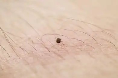 螨虫是一种体型非常微小的节肢动物,大小一般在0.1毫米~0.