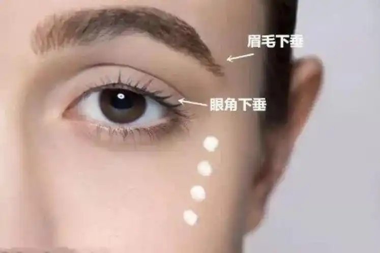 眉形不佳眉毛下垂怎么办