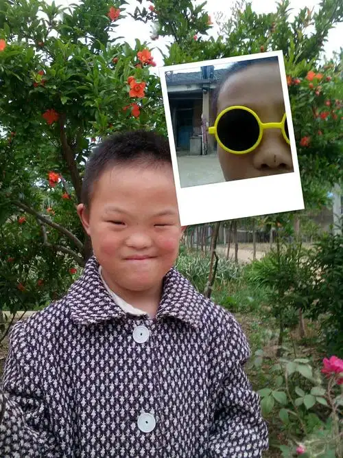 我的宝宝是先天发育迟缓,什么都比别人家的孩子小,现在已经十一岁,在