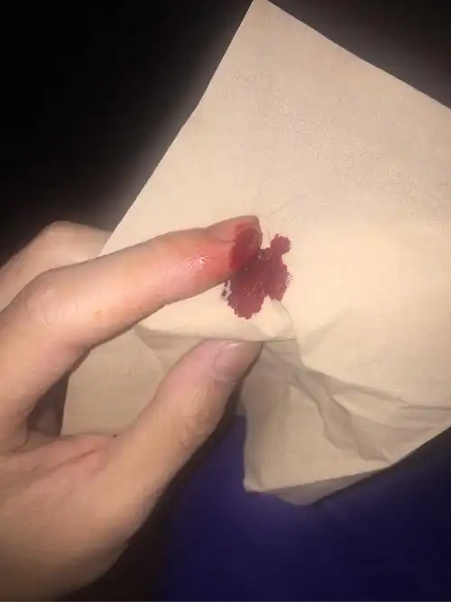 切菜时切到手是一种什么样的体验?