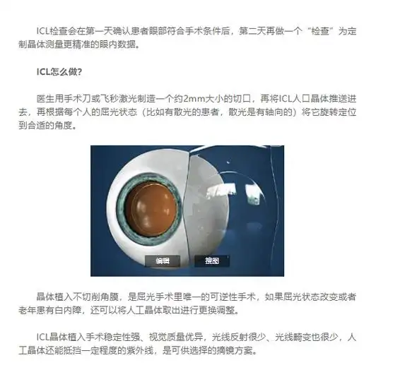 成都爱尔周进解析1000,1800度近视患者可选?摘镜方案!