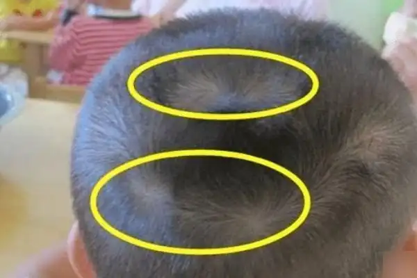 女孩头上两个旋好不好?