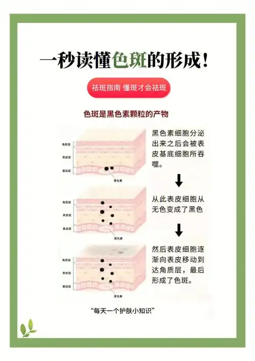 小御科普|色斑色斑是黑色素颗粒的产物祛斑不仅需要一个过程,更需要