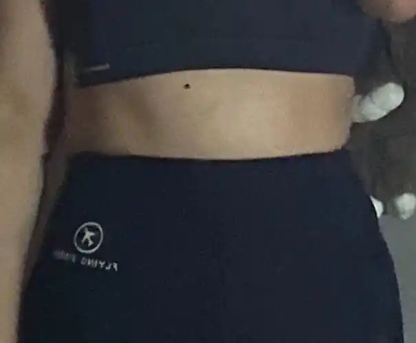 肚子上这个坑是怎么回事