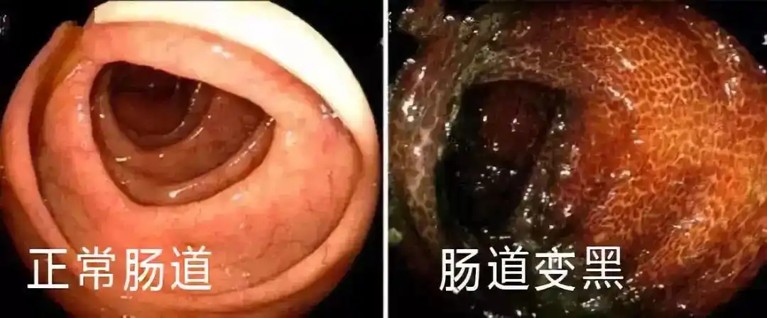 好运也来了_肠道