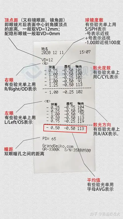 怎么看医院测眼睛度数的单子?