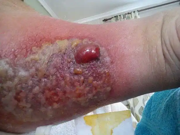 动物篇(23.5)·虻叮咬,重口慎入