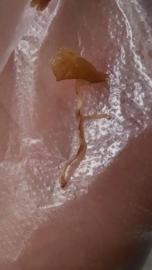 如图,刚才煮熟的猪肉里吃出了貌似虫子的东西,请问这是虫子吗?