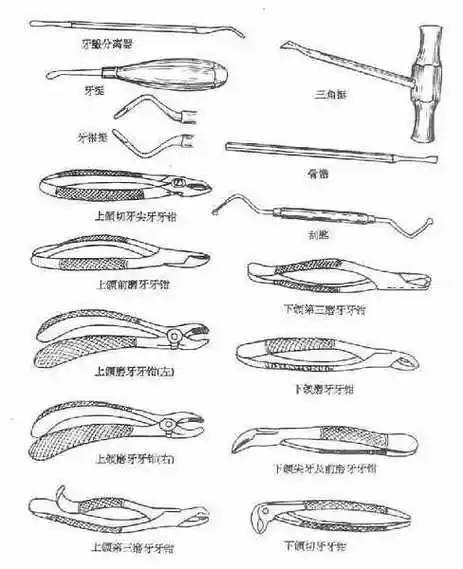 拔牙术(exodontia)_《口腔科学》_【中医宝典大全】