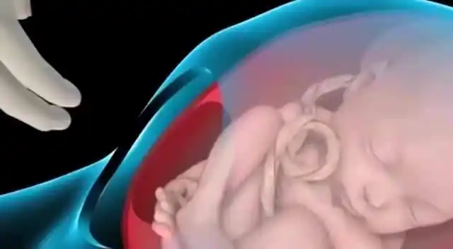 原创孕妈须知:想避免胎儿脐带绕颈,那这4件事你可别轻易"触碰"