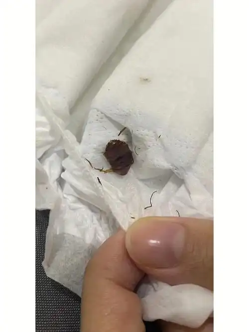 帮宝适黑金帮发现蟑螂客服甩锅不认