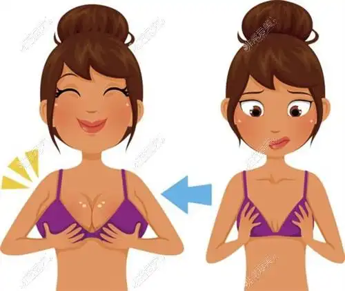 哈尔滨乳房上提手术亲身经历,乳房悬吊术-乳房再造姐妹必看-非常爱美