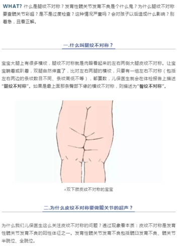 宝宝腿纹不对称,宝爸宝妈怎么办?-郑州人民医院官方网站