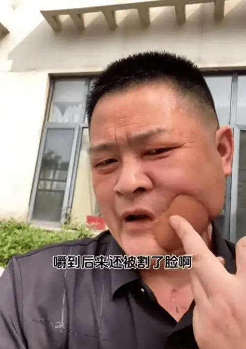 38岁那年,网红天城哥因为20年的槟榔史,被迫割掉了左脸……23岁那年