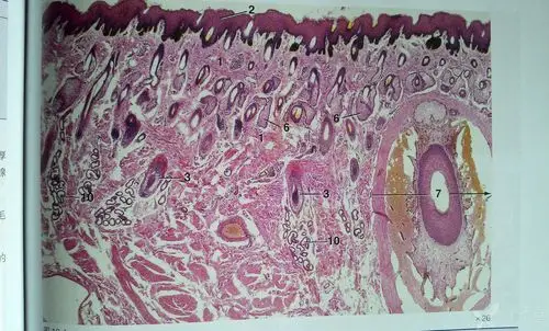 【求助】求教,如何识别皮肤的he染色切片!