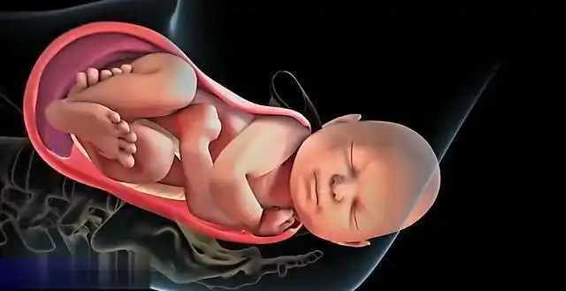 女人生孩子究竟难产在哪几张图告诉你答案看完忍不住心疼女人