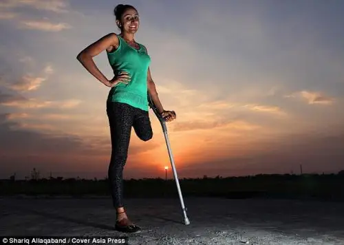 女护士车祸后单腿跳舞 被指用天赋感动世界(图)