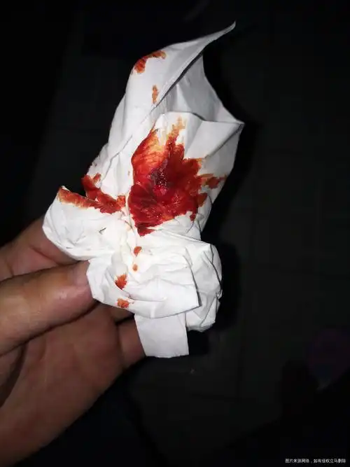 流产几天了今天开始一直流红色的血直接掉了