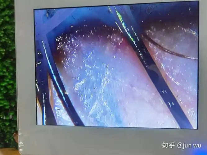 实时记录美发店头皮检测毛囊检测全过程是不是坑有待验证