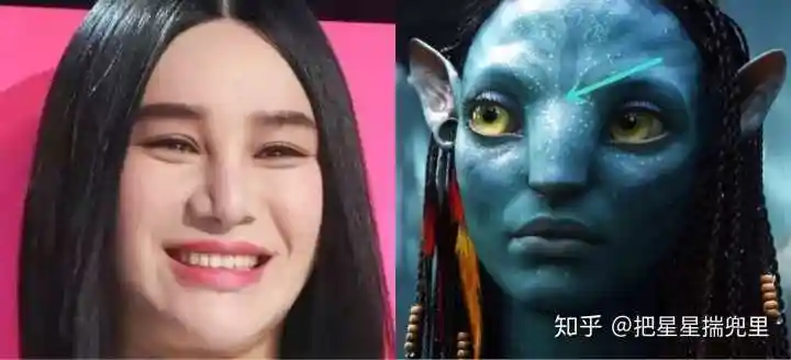 你的山根处有些宽,有点阿凡达鼻子的感觉,是注射过玻尿酸还是鼻子本身