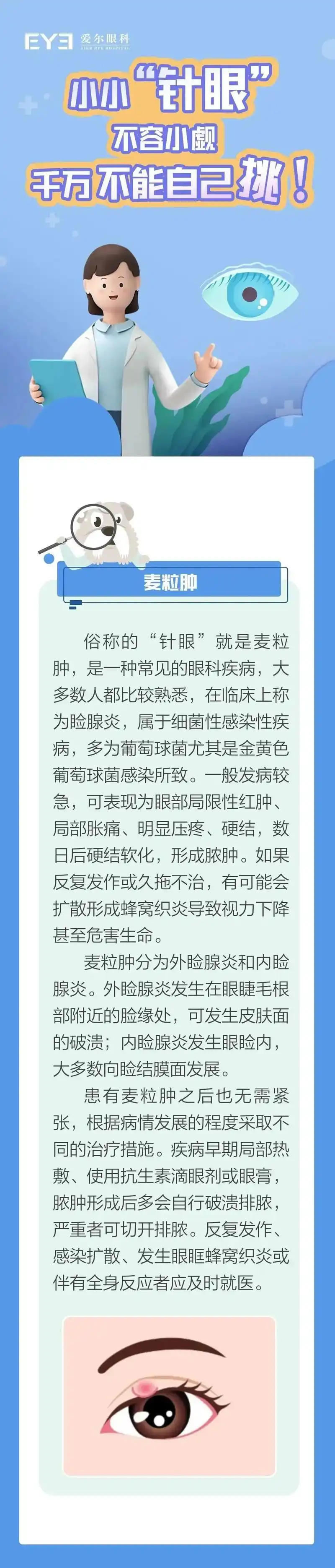 爱尔眼科专家提醒您:针眼真的不能自己挑!