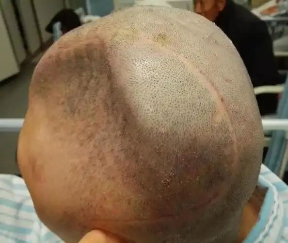 (打开天窗说亮话) - 好大夫在线