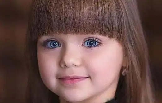 歌舞伎面谱综合征是这个病的全称.