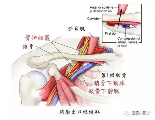 供应上肢的神经( 臂神经丛) ,血管( 锁骨下动/静脉 ) 由 颈椎出发