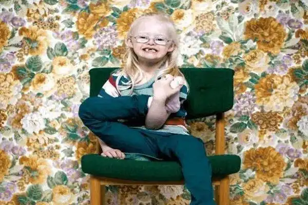 天使综合症是什么病从出生就没有停止过微笑基因缺陷