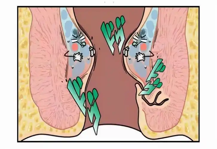 一,肛门瘙痒的原因