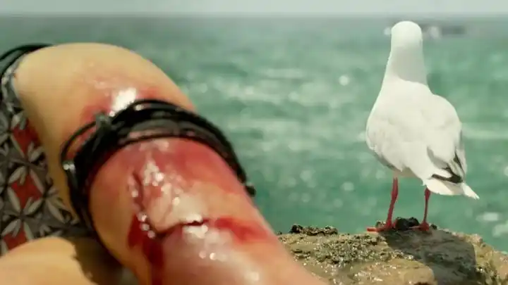 美女被鲨鱼咬独身爬上礁石 自己给自己缝针我看着都痛!