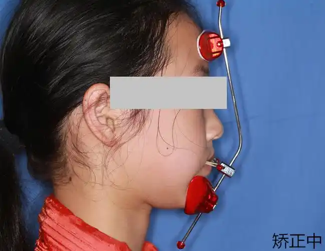 哇变化太大了地包天的救星