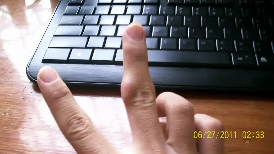 手指关节处囊肿