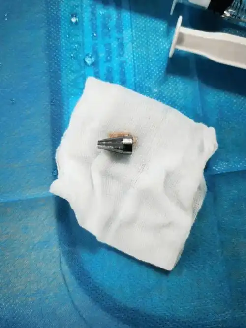 小孩咳嗽不停,医生竟从气管里取出…家长不要再犯这个错了!_异物