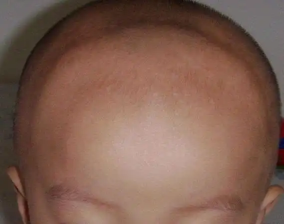 新生儿的这3个部位非常脆弱,宝妈们要多注意,避免伤到宝宝哦