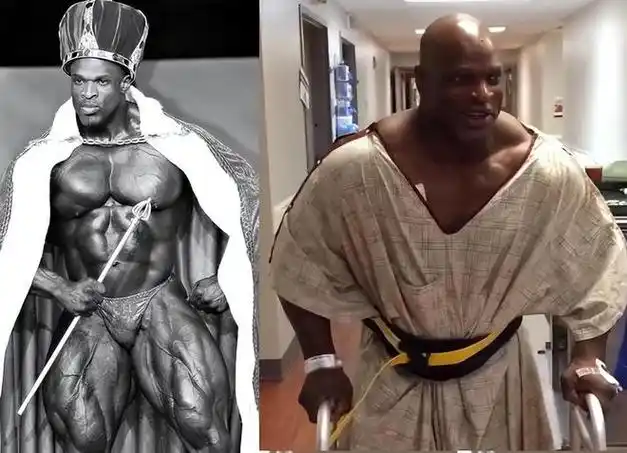 健美之王罗尼库尔曼成为一名健美运动员背后的残酷真相