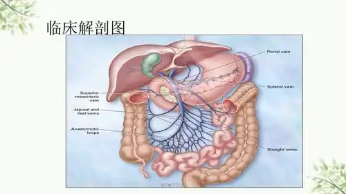 肠系膜静脉血栓形成课件