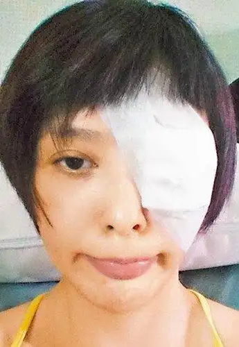 [明星新闻]萧淑慎左眼眼球表面撕裂 自嘲变"独眼龙"(图)