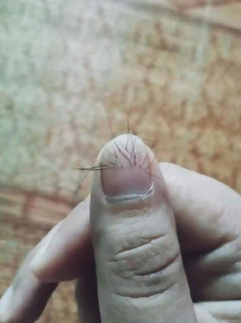 网友提问:指甲上长毛正常吗?