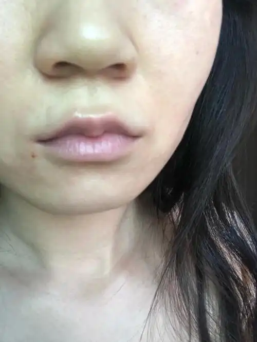 嘴唇发白无血色