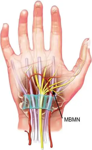 废物的循环往往没有其他关节来的快,所以手腕疼痛的康复周期也比较长