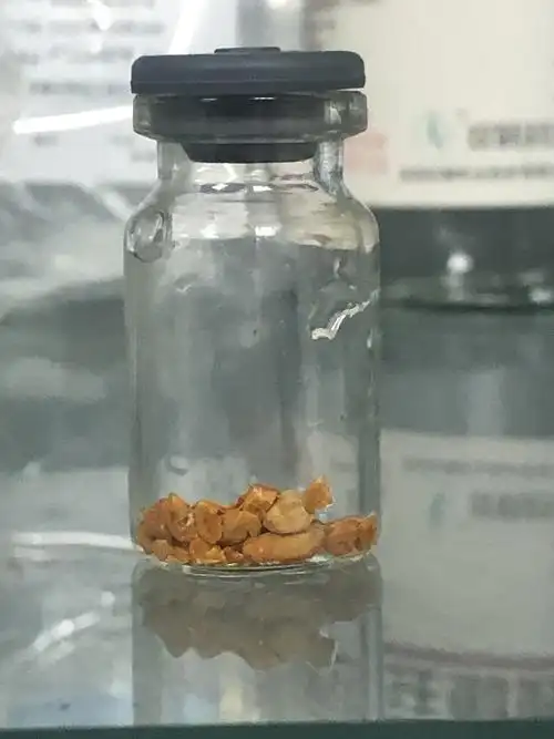 尿酸结石怎么治