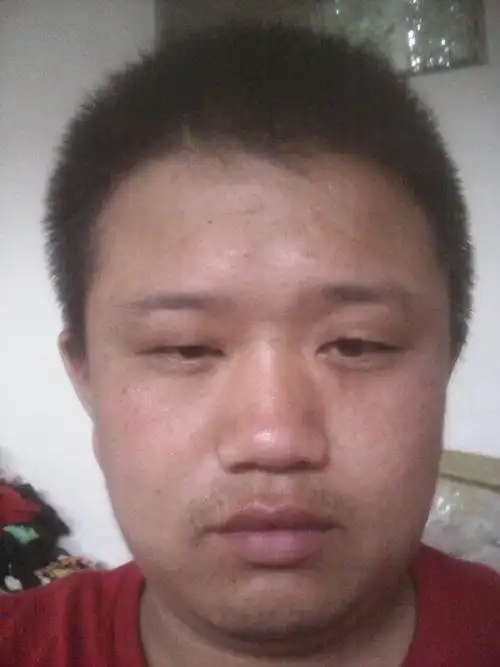 我脸上的泪痕怎么去除