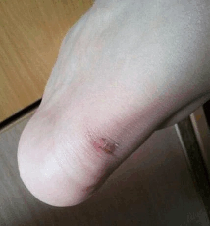 如何穿高跟鞋不痛